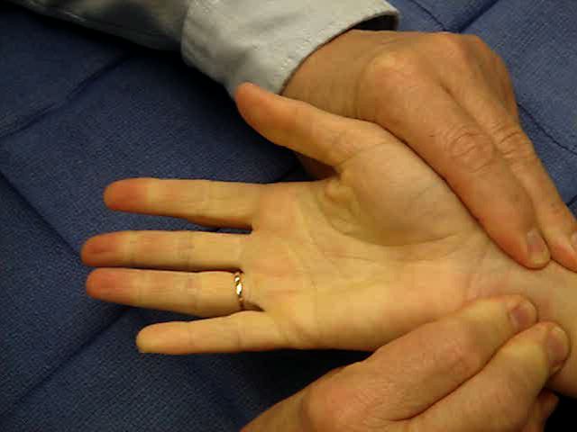 Allen Test Hand Surgery Resource